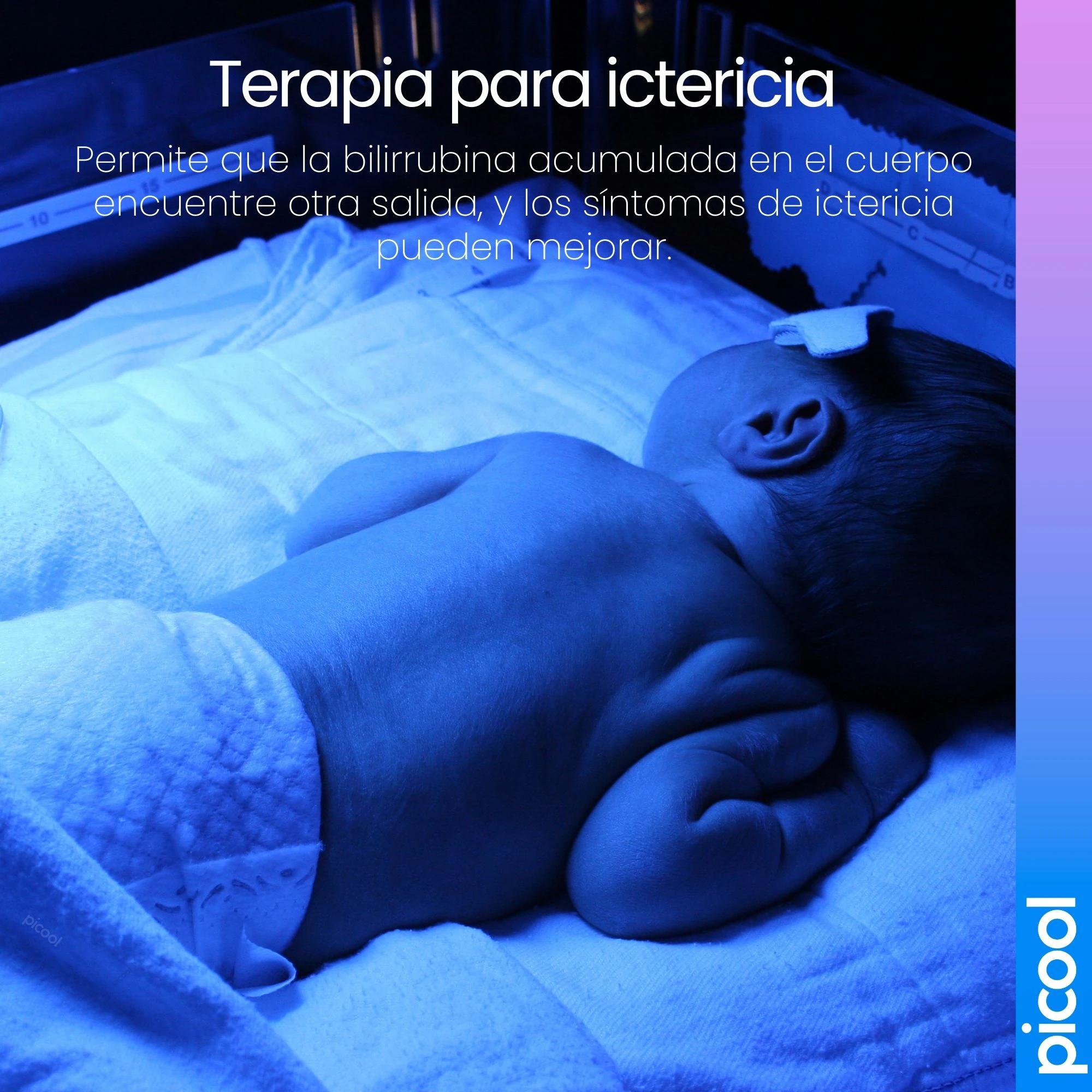 lamparas para bebes con ictericia - Cómo bajar la bilirrubina en un bebé en casa